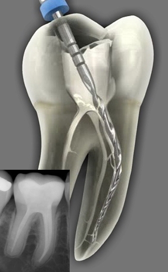 Endodoncie